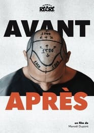 Avant/Après