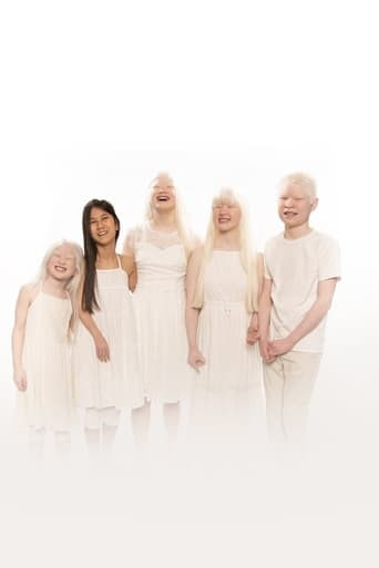 Born with Albinism