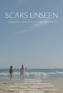 Scars Unseen