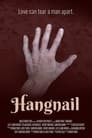 Hangnail