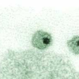 Season 24 Episode 14